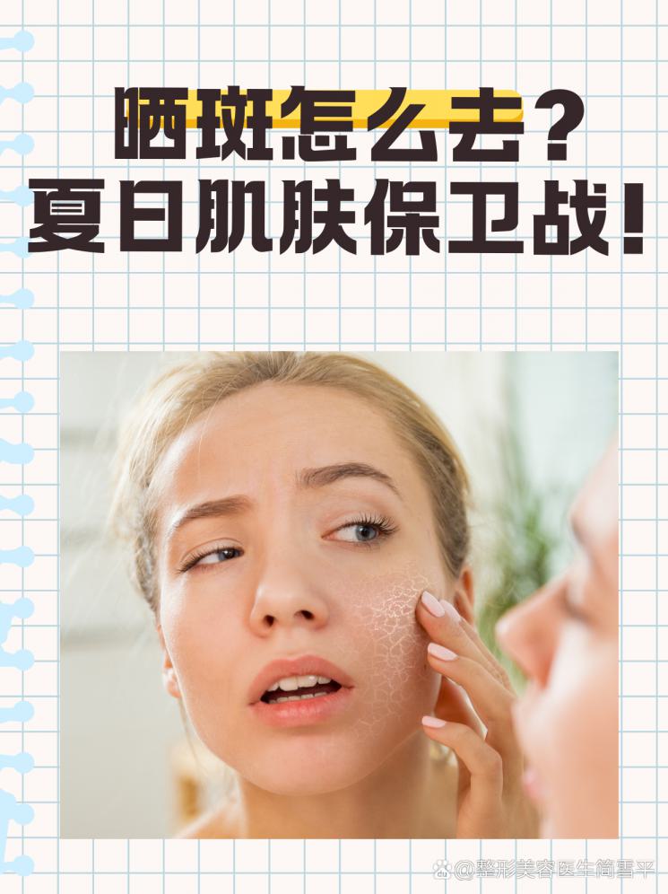 晒斑怎么去？夏日肌肤保卫战！