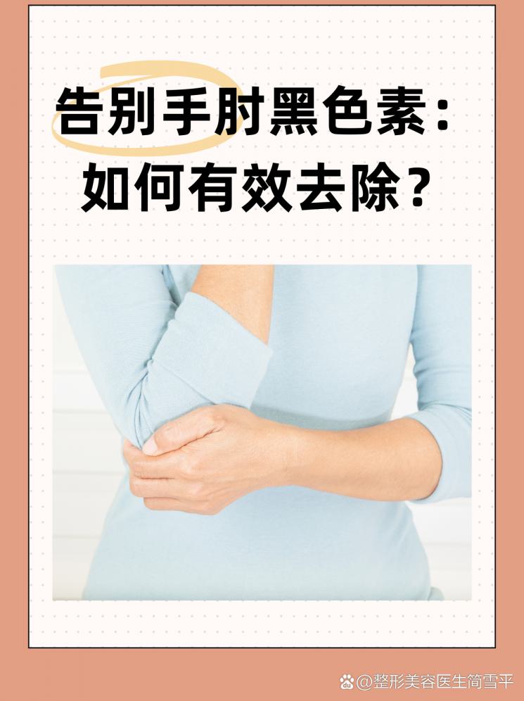告别手肘黑色素：如何有效去除？