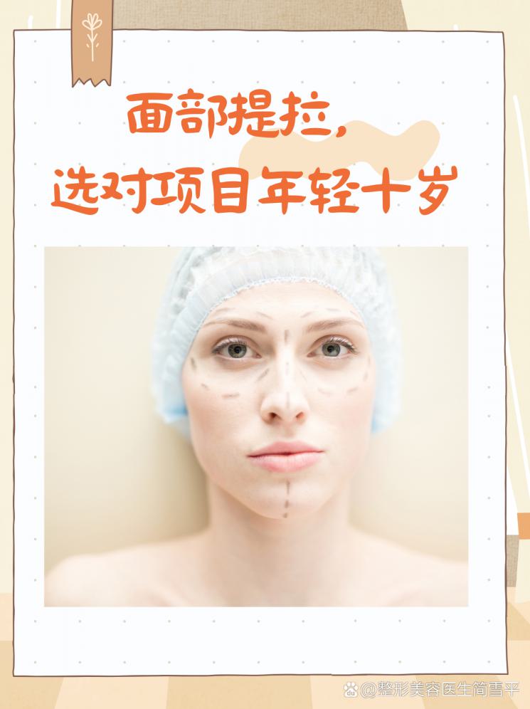 面部提拉，选对项目年轻十岁