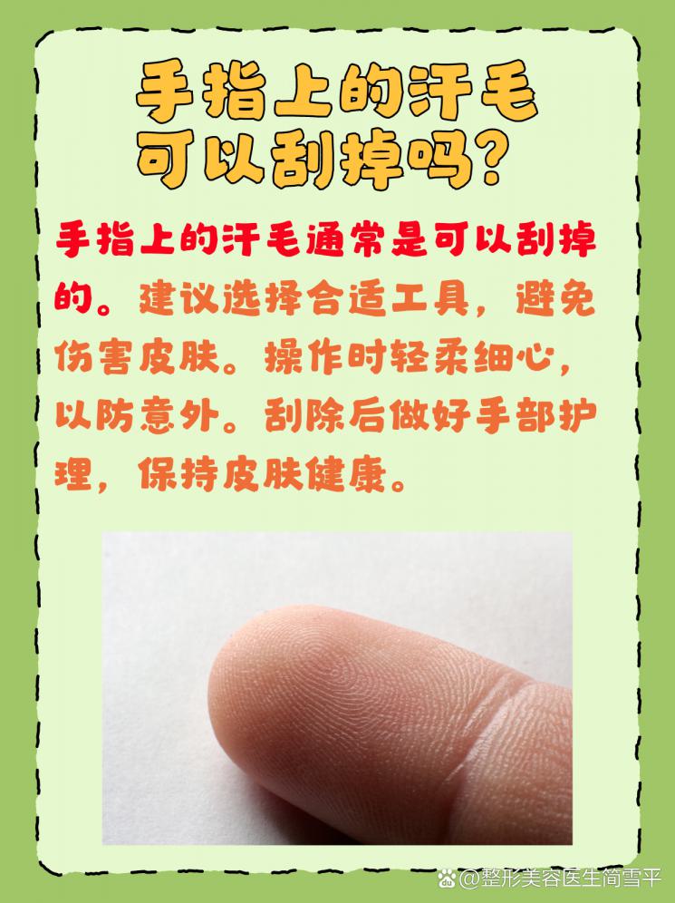 手指汗毛，刮掉还是留下？美容小知识大公开！