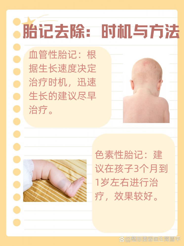 胎记治疗时机：把握去除年龄