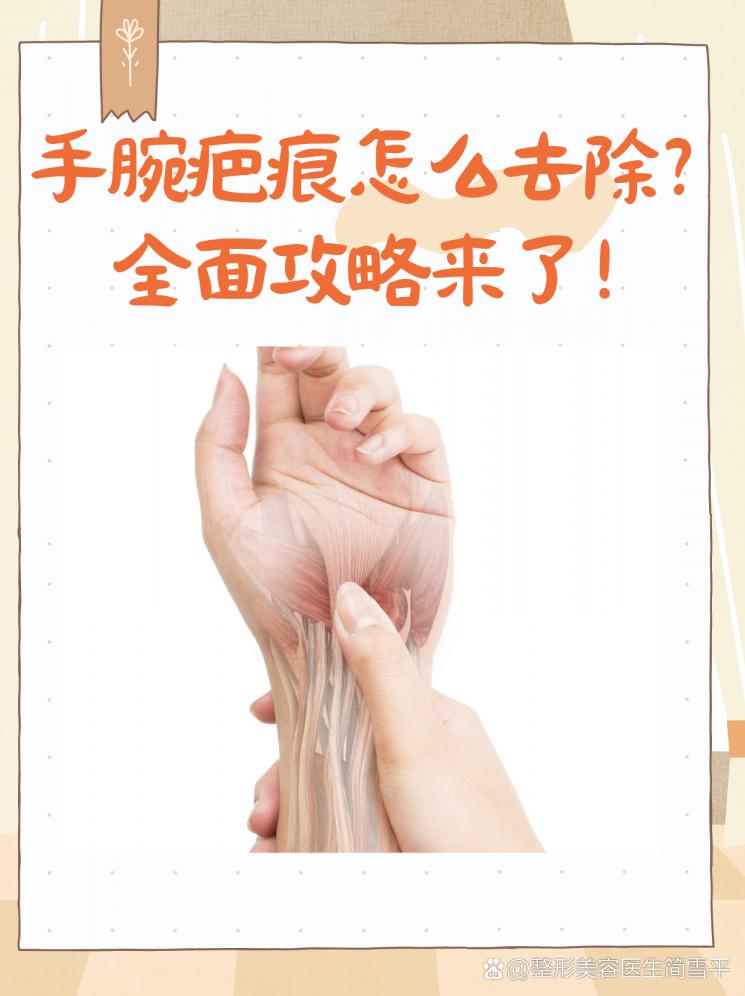 手腕疤痕怎么去除？全面攻略来了！