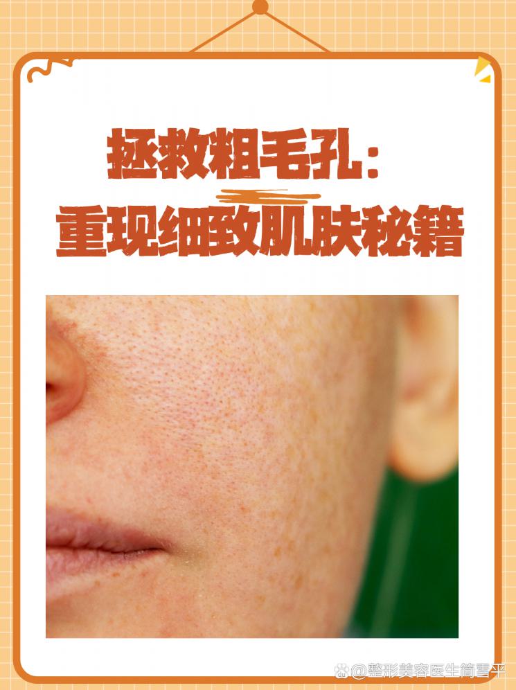 拯救粗毛孔：重现细致肌肤秘籍