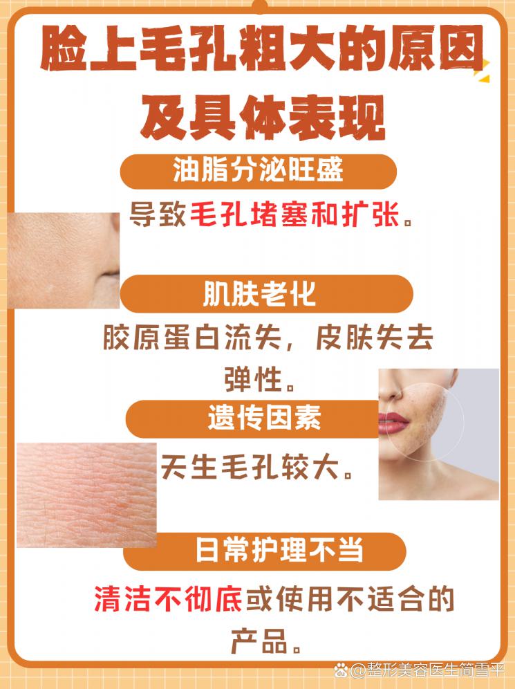 拯救粗毛孔：重现细致肌肤秘籍