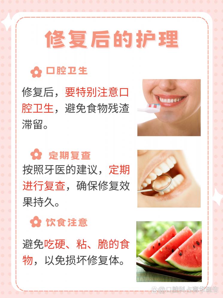门牙缝大怎么修复？美观秘籍大公开！