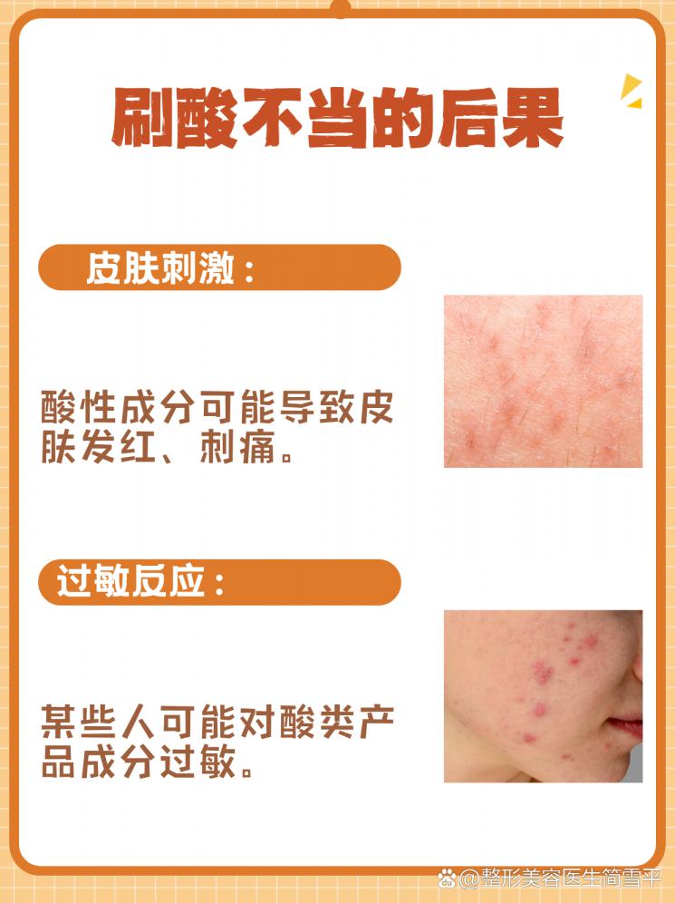 揭秘刷酸：美丽肌肤的秘密武器