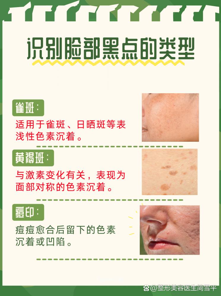 告别脸部黑点：肌肤净白的秘诀