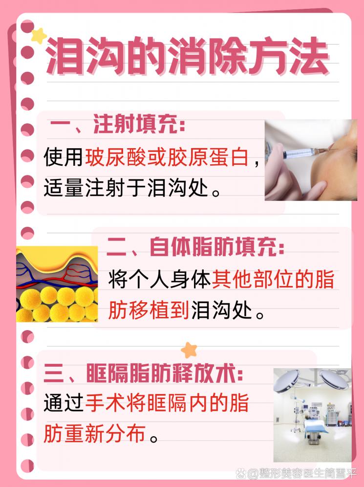 泪沟消除：美丽眼周的秘诀