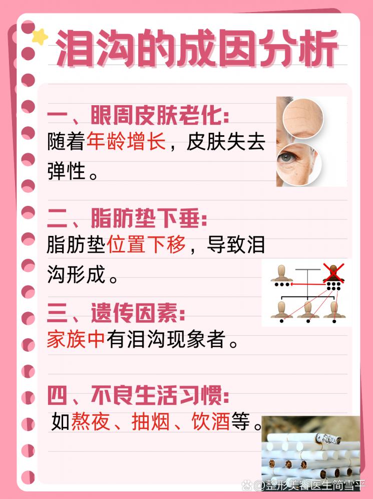 泪沟消除：美丽眼周的秘诀
