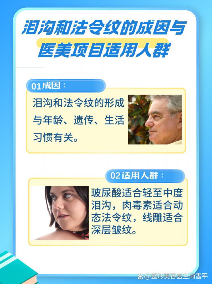 逆龄秘籍：泪沟法令纹的医美解决方案