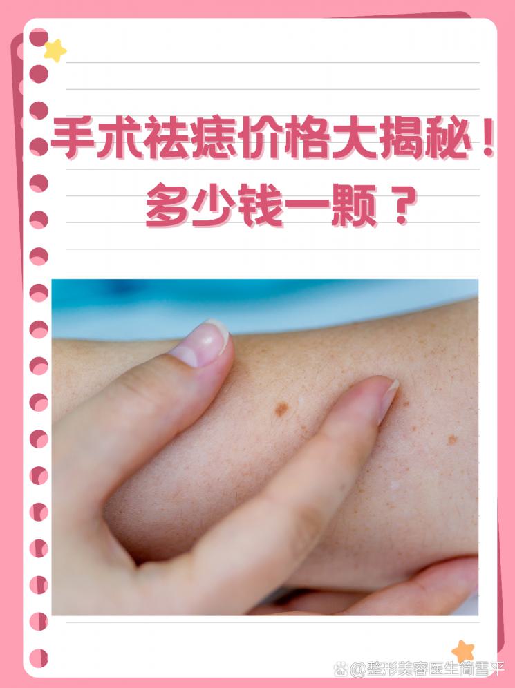 手术祛痣价格大揭秘！多少钱一颗？