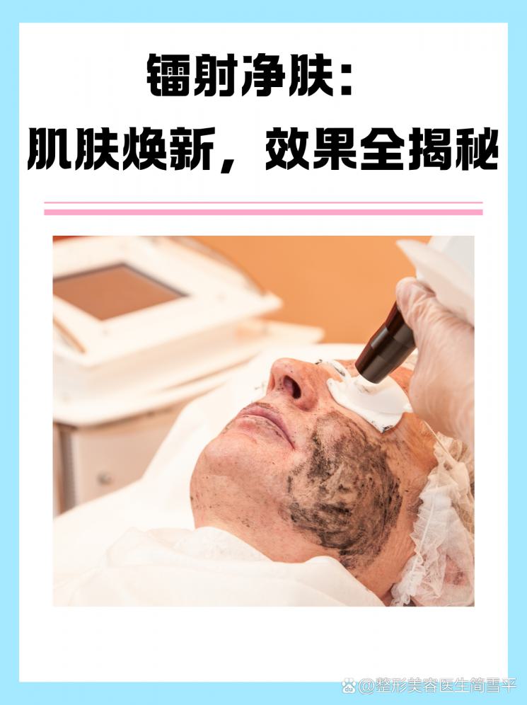 镭射净肤：肌肤焕新，效果全揭秘