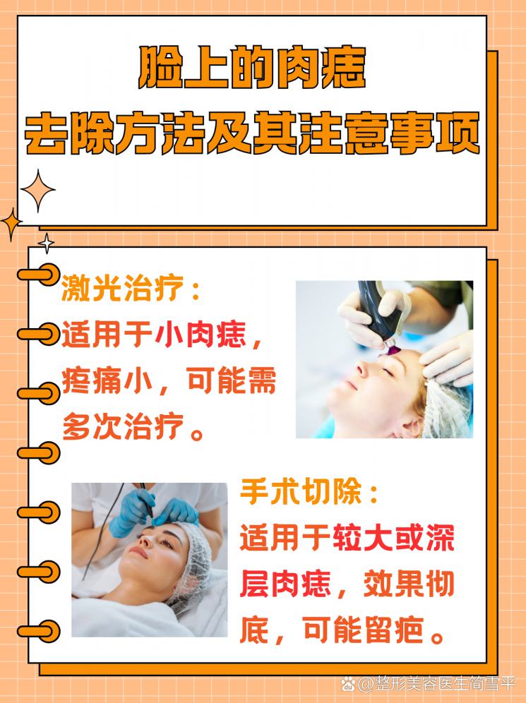 肉痣烦恼bye-bye：安全去除指南