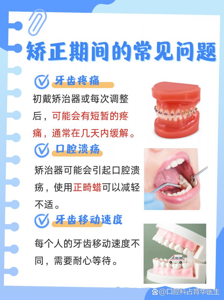 矫正牙齿全攻略！注意事项大盘点！