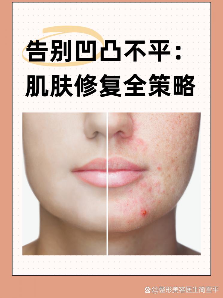 告别凹凸不平：肌肤修复全策略