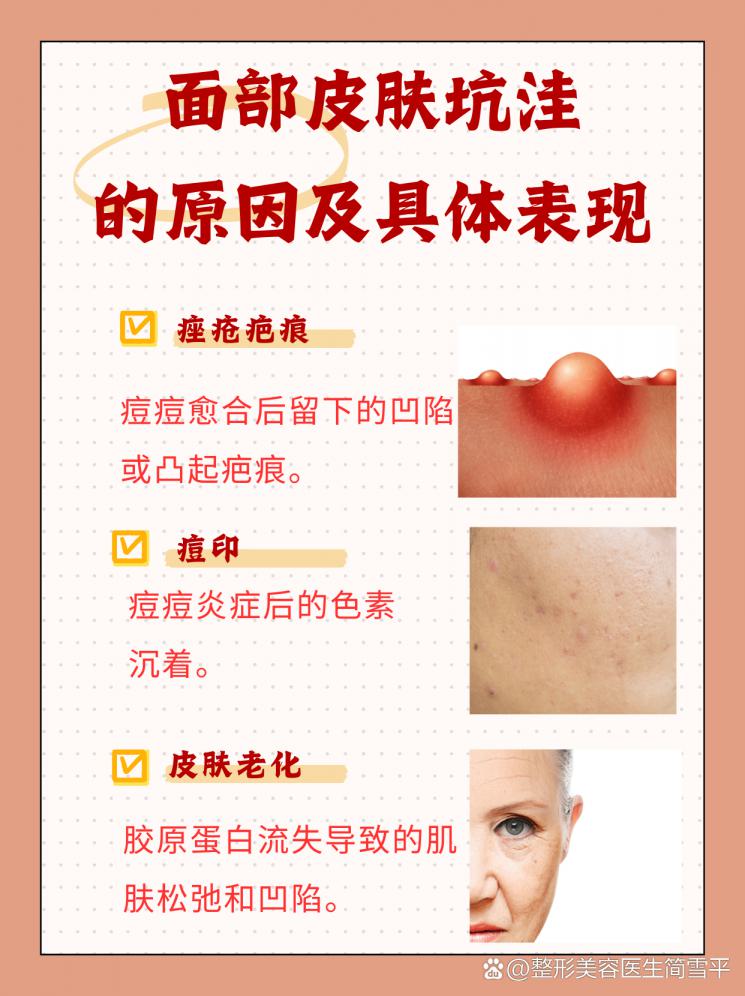 告别凹凸不平：肌肤修复全策略