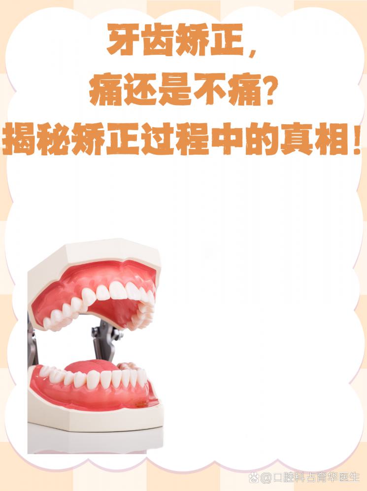 牙齿矫正，痛还是不痛？揭秘矫正过程中的真相！