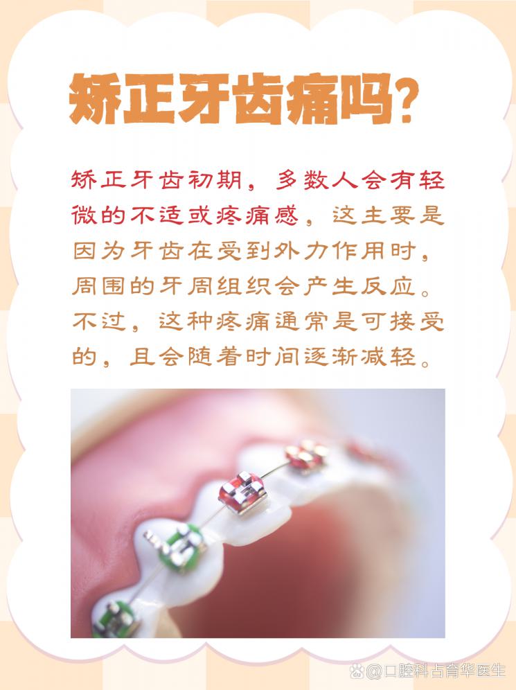 牙齿矫正，痛还是不痛？揭秘矫正过程中的真相！