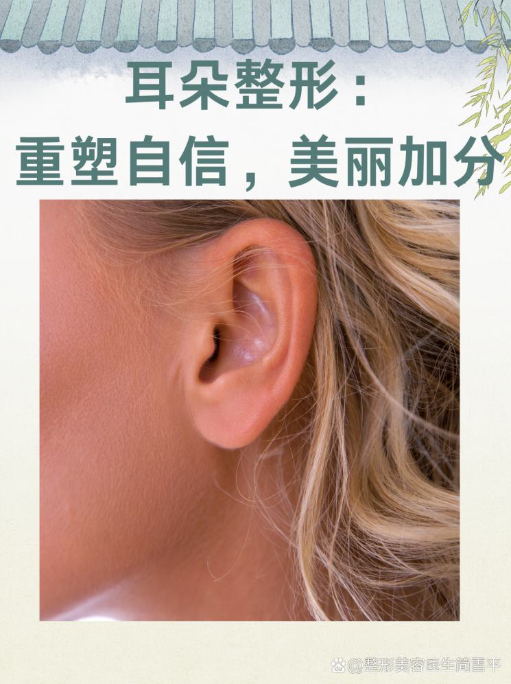 耳朵整形：重塑自信，美丽加分