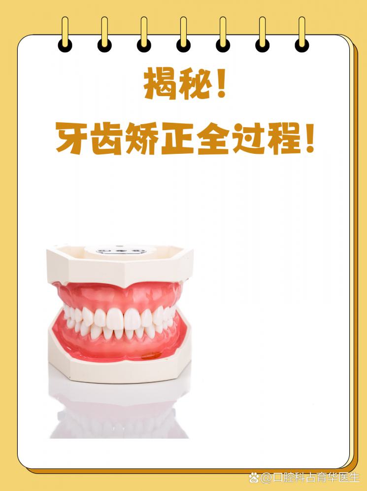揭秘！牙齿矫正全过程！