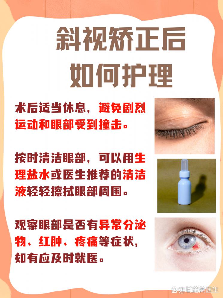 斜视矫正：揭秘手术费用与治疗路径