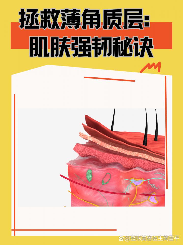 拯救薄角质层：肌肤强韧秘诀