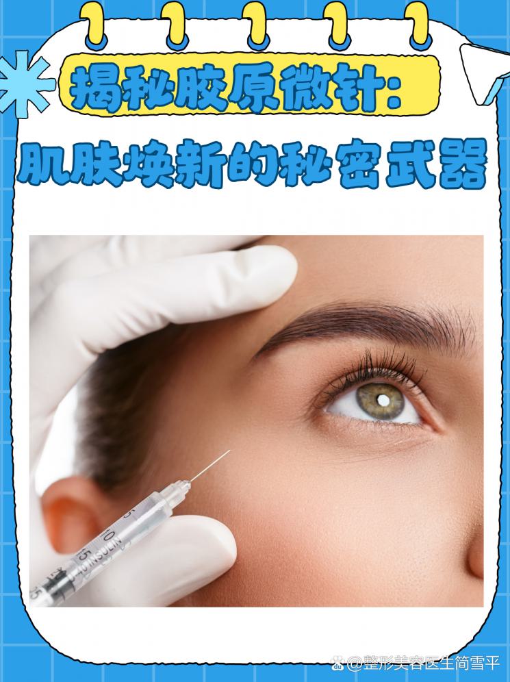 揭秘胶原微针：肌肤焕新的秘密武器