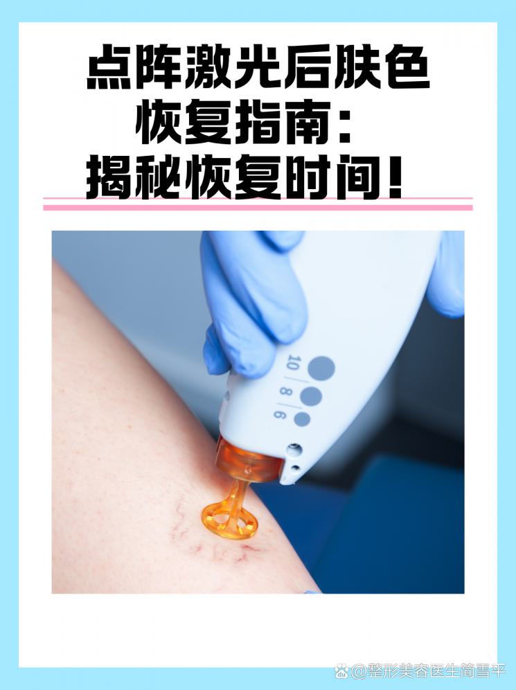 点阵激光后肤色恢复指南：揭秘恢复时间！