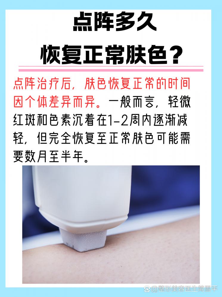 点阵激光后肤色恢复指南：揭秘恢复时间！