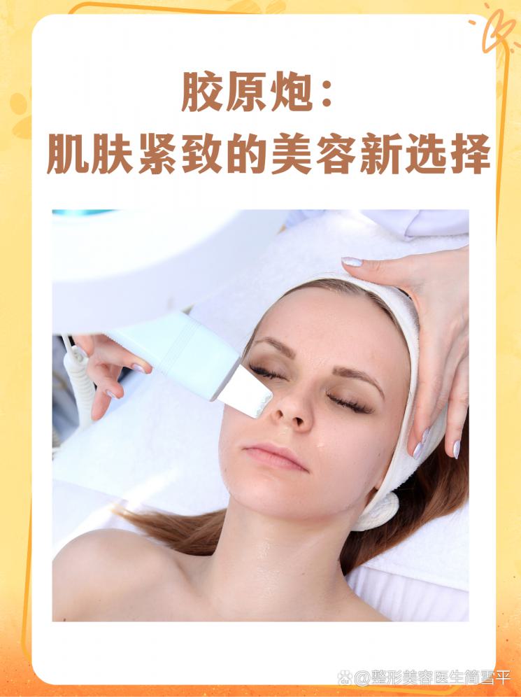 胶原炮：肌肤紧致的美容新选择