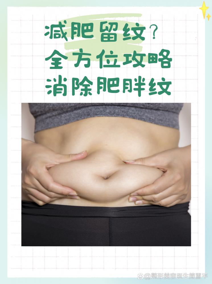 减肥留纹？全方位攻略消除肥胖纹