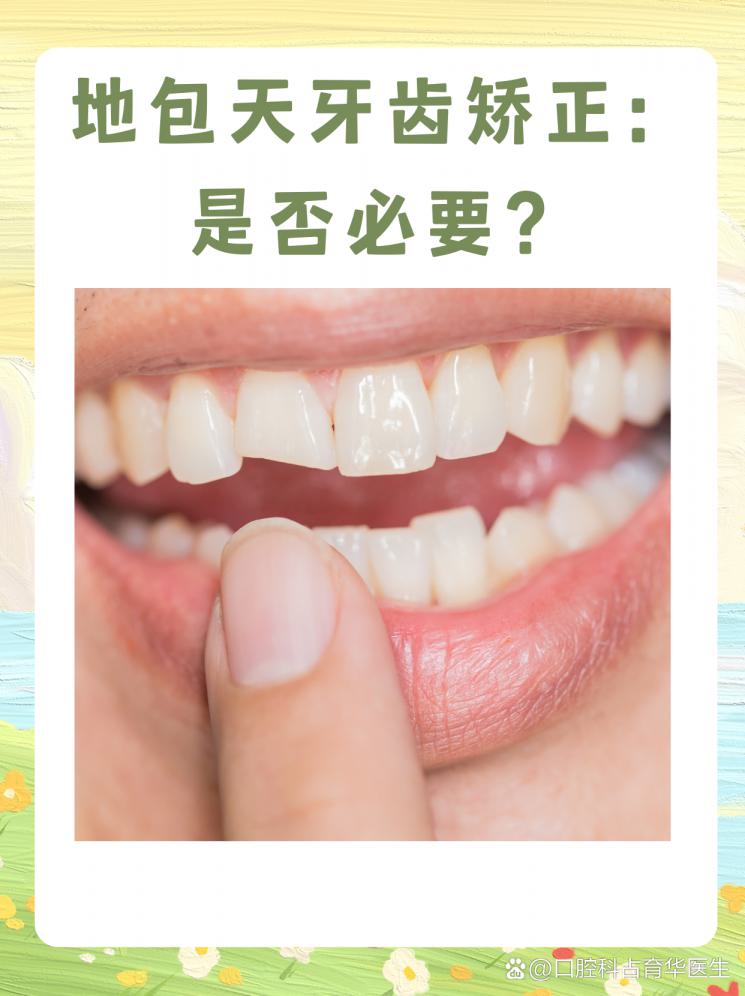 地包天牙齿矫正：是否必要？