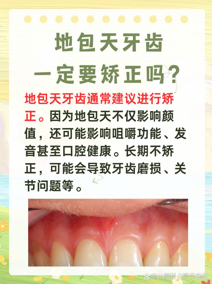 地包天牙齿矫正：是否必要？