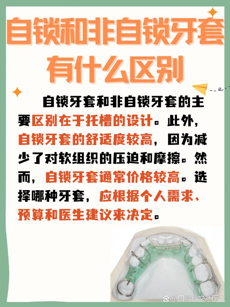 自锁牙套VS非自锁牙套，矫正牙齿怎么选？