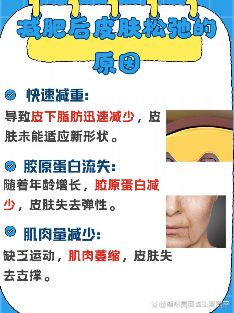 重塑紧致：减肥后肌肤紧致指南