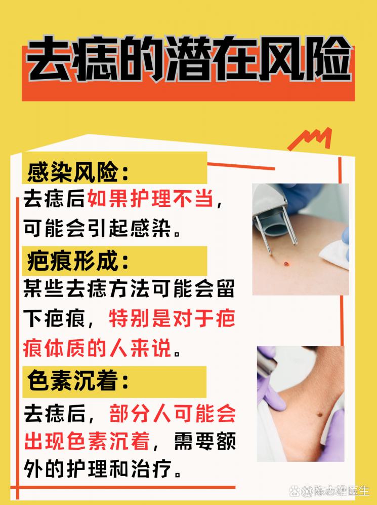 快速有效去痣秘籍：揭秘最佳方法