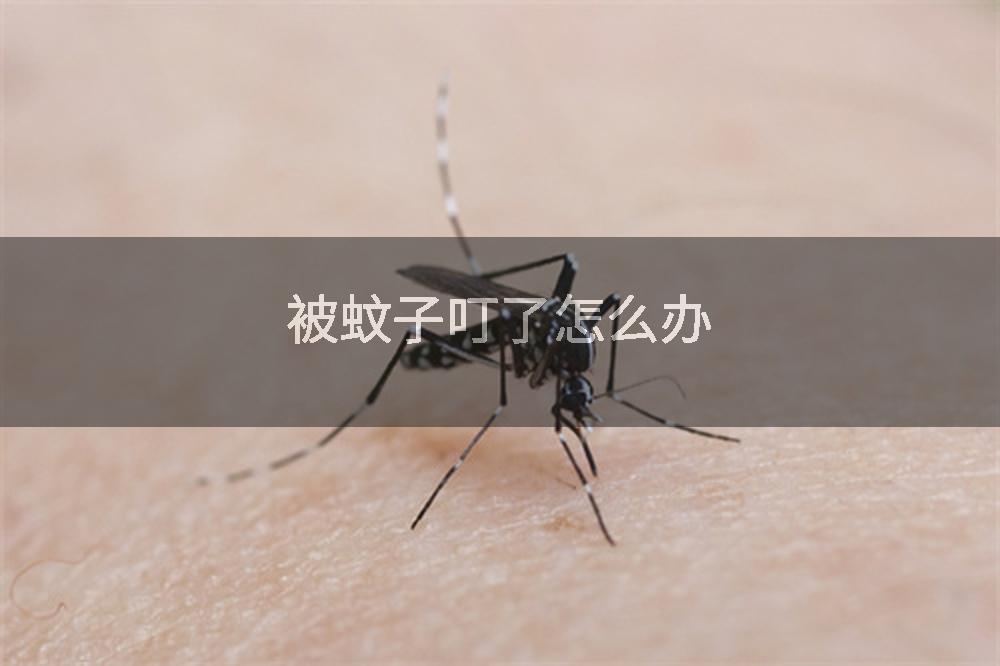 被蚊子叮了怎么办
