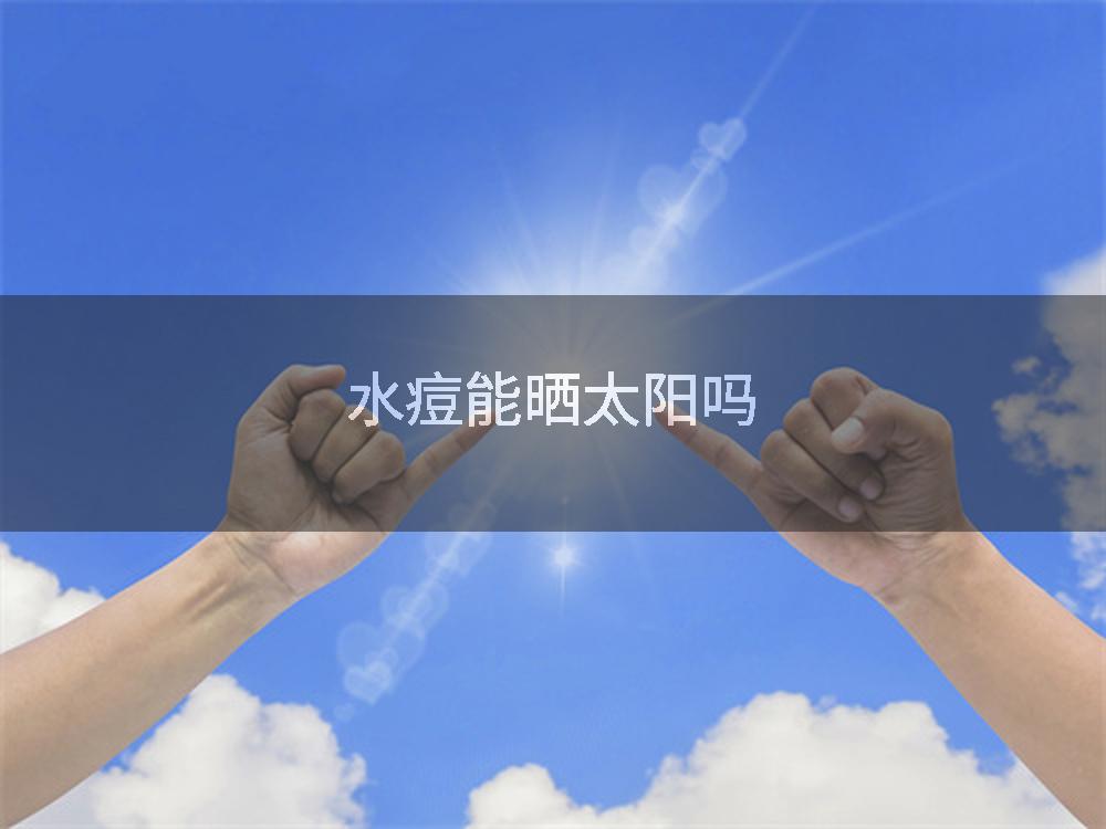 水痘能晒太阳吗