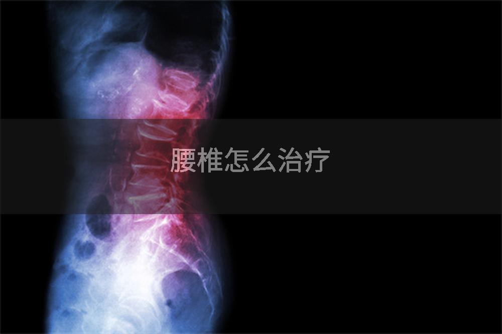 腰椎怎么治疗