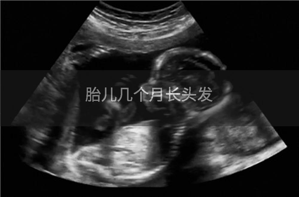 胎儿几个月长头发