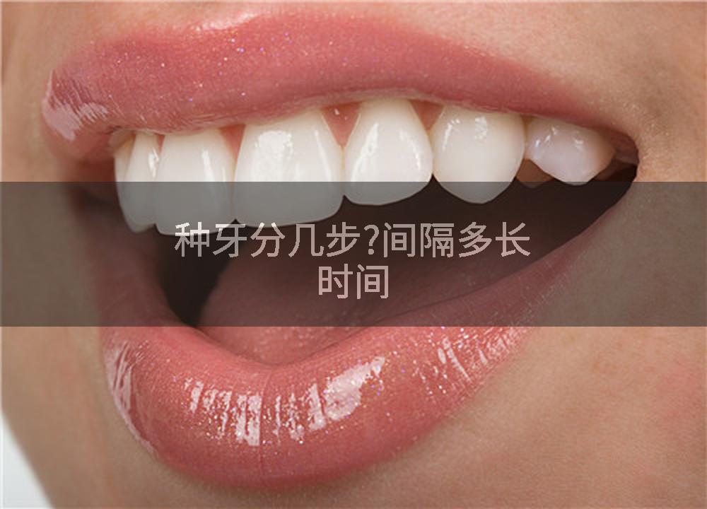 种牙分几步?间隔多长时间