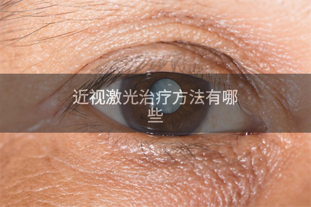 近视激光治疗方法有哪些
