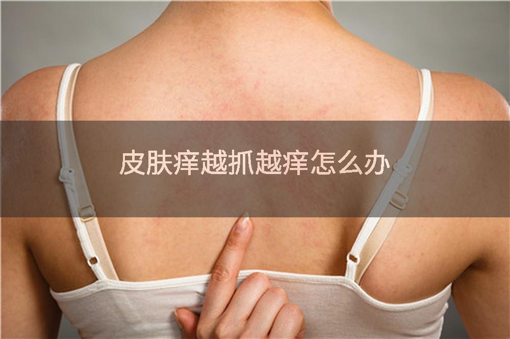 皮肤痒越抓越痒怎么办