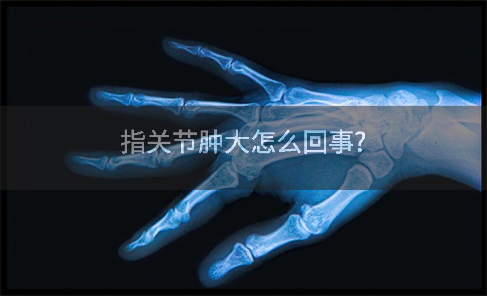 指关节肿大怎么回事?