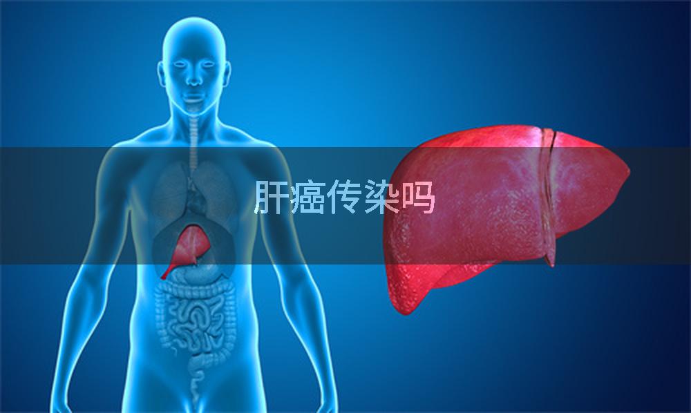 肝癌传染吗