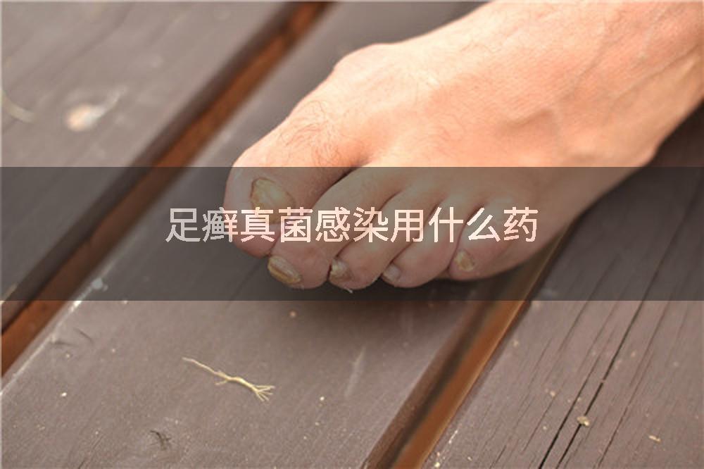 足癣真菌感染用什么药