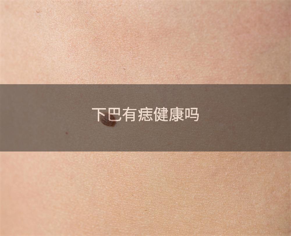 下巴有痣健康吗