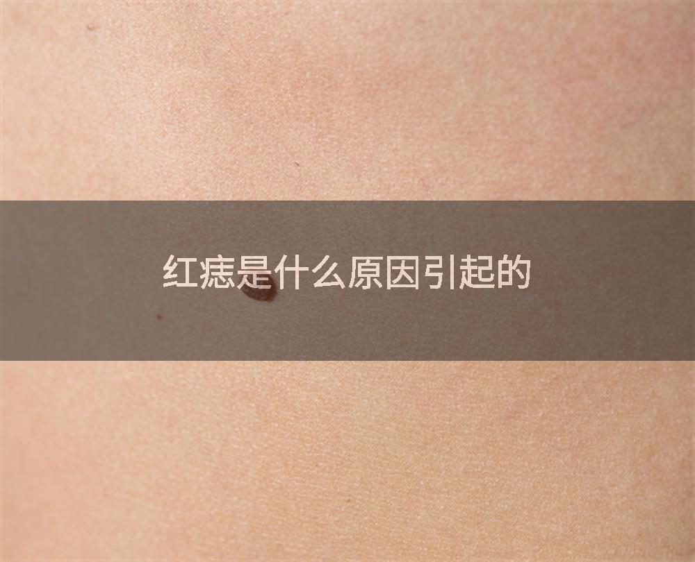 红痣是什么原因引起的
