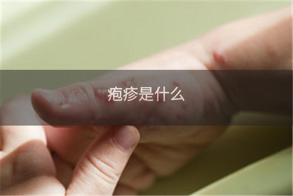疱疹是什么