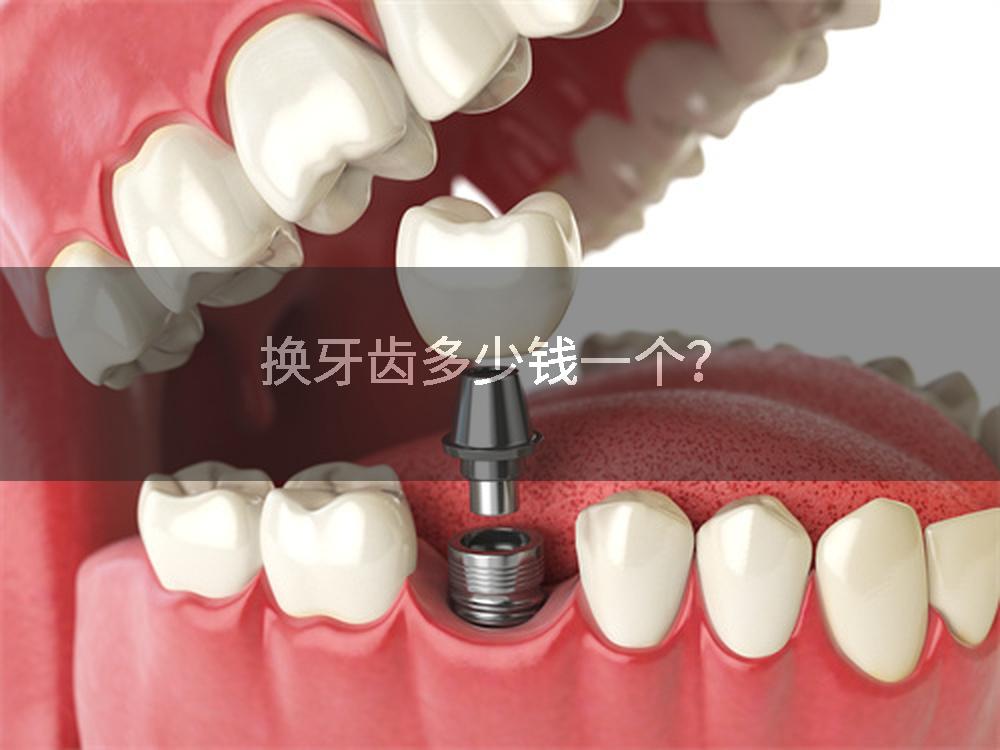 换牙齿多少钱一个？